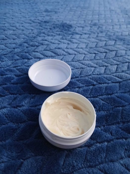 Себореен дерматит , себорея , крем , лечение , терапия , пъпки