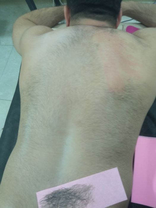 Депиляция мужская и женская