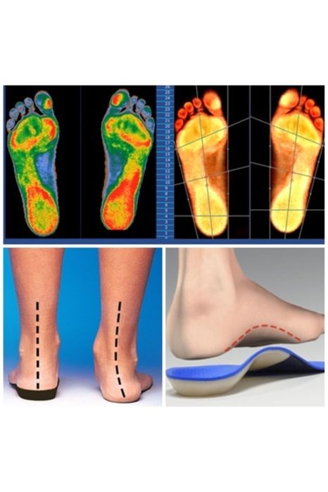 Ортопедические стельки Turkey