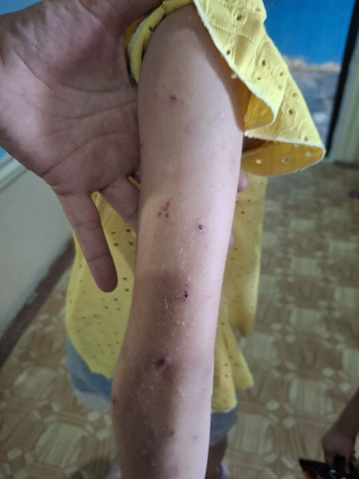 Dezinfeksiya Navoiy 24/7 — Kafolatli Litsenziya bor