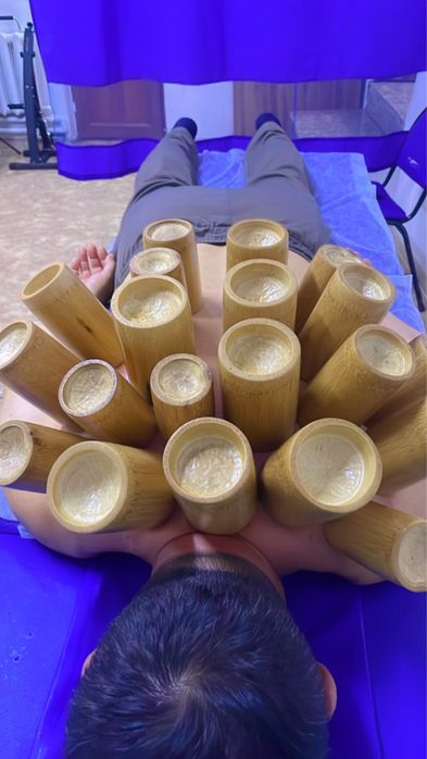 лечение Иглотерапией в Шымкентте