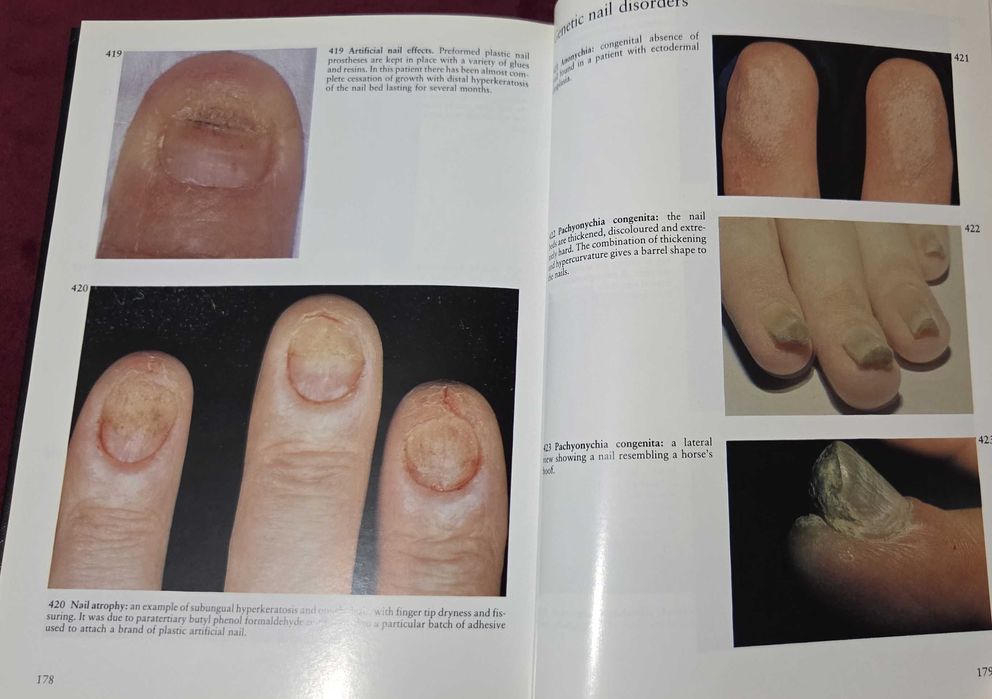 A Colour Atlas of the Hair, Scalp and Nails