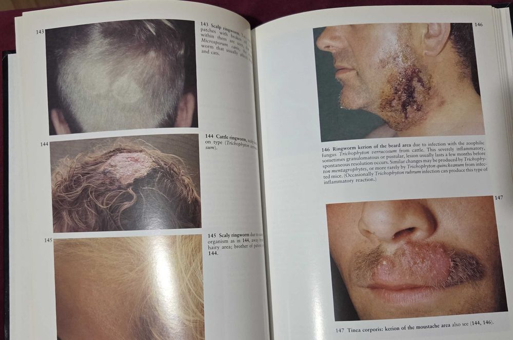 A Colour Atlas of the Hair, Scalp and Nails