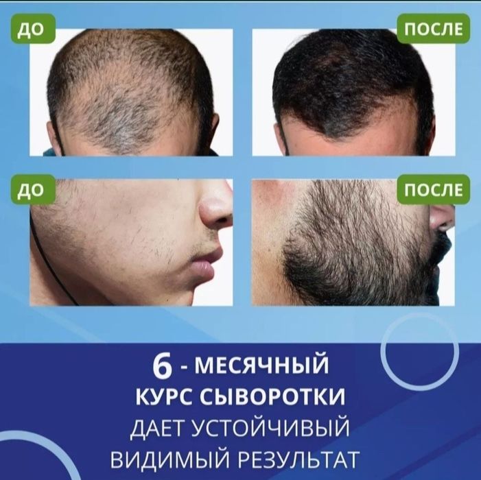 Лосьон для волос