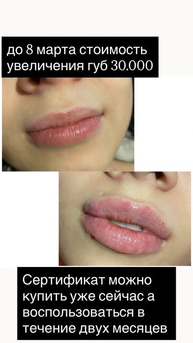 Наращивание ресниц и волос