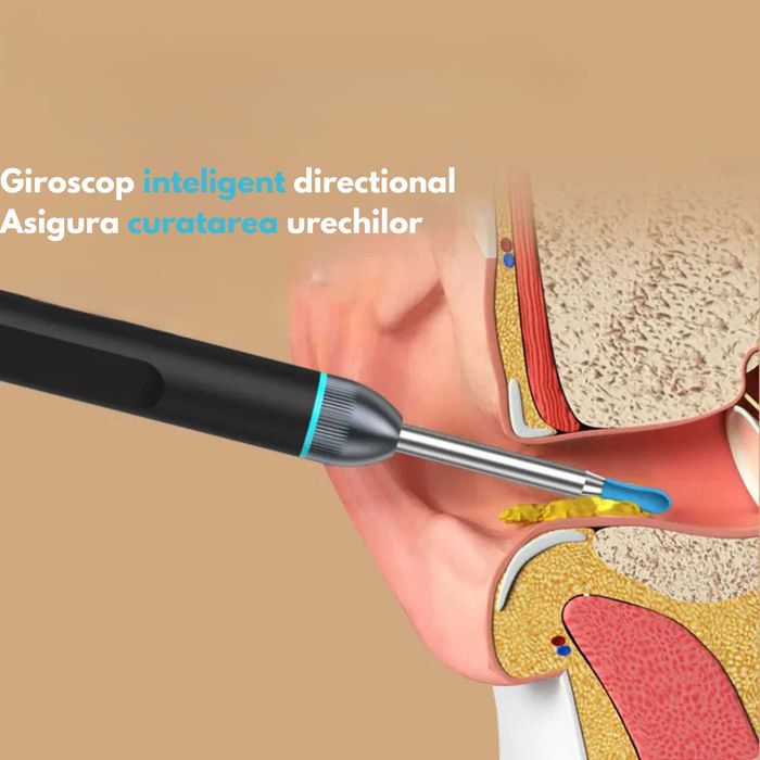 Otoscop smart, aparat pentru curatarea urechilor, UltraHD, Wi-Fi