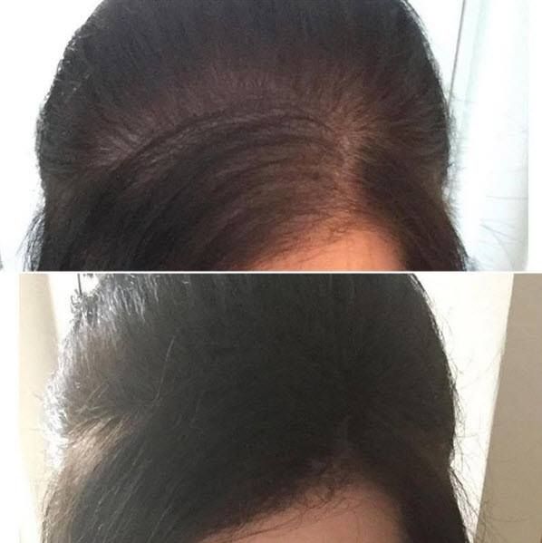 Кератинови фибри за коса | ХИТ ЦЕНА 22.00 лв. на фибри Тoppim