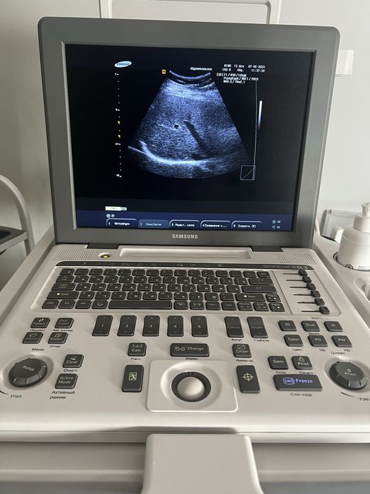 Продается УЗИ аппарат