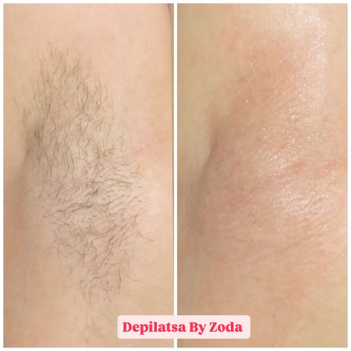 Depilatsiya faqat ayyollar qizlar uchun
