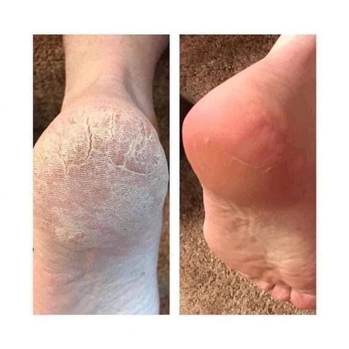 Педикюр маникюр титановая нить