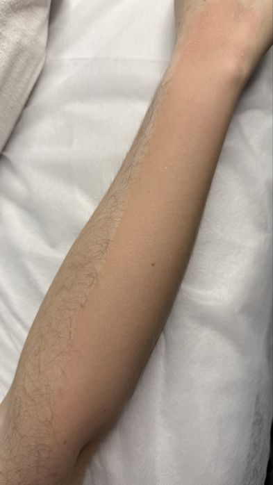 Обучаю депиляции