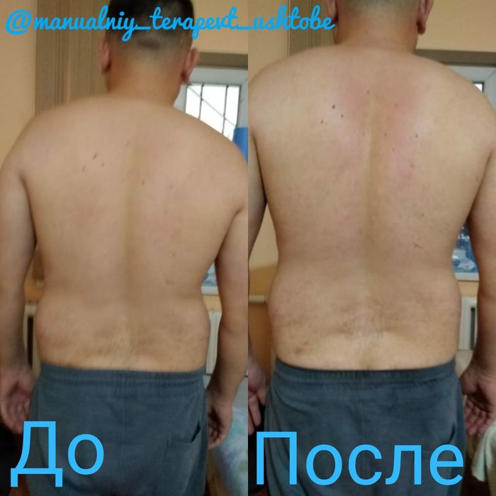 Хиджама/Массаж на выезд