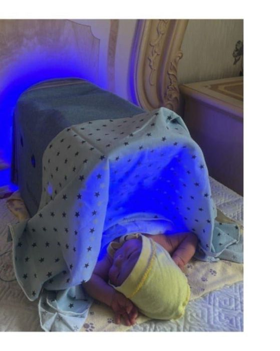 Фотолампа, чакалокни зарарсиз сертификатланган лампа билан даволаш