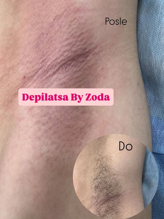 Depilatsiya faqat ayyollar qizlar uchun