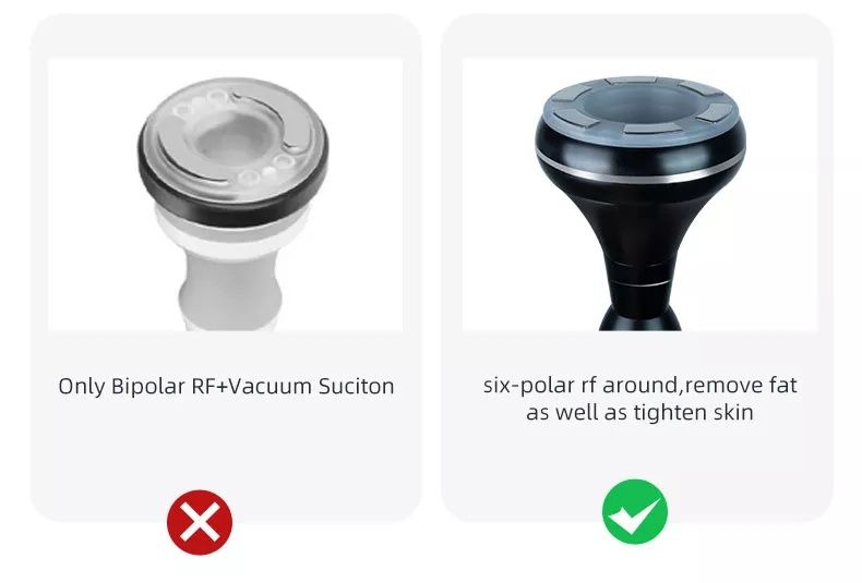 Апарат за Кавитация, SMART RF + Вакум за лице и тяло S - Shape , 5 в 1