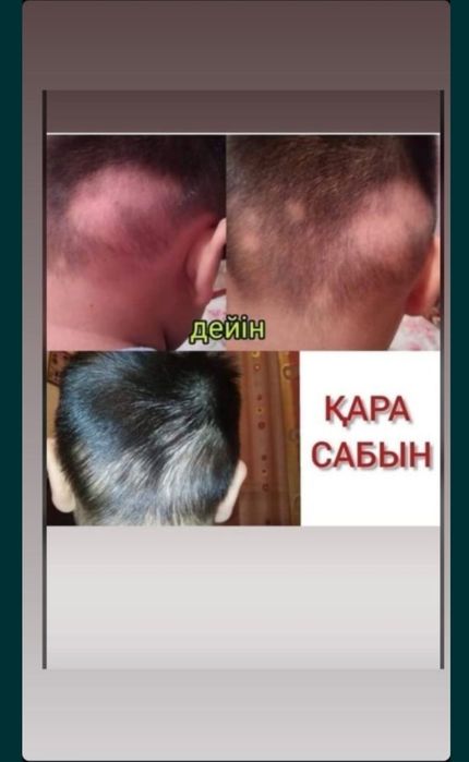 Емдік қара сахар сабын