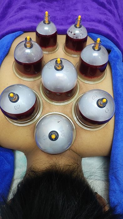 Оздоровительная хиджама.