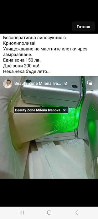 Криолиполиза за премахване на мазнините!!! Безоперативна липосукция!!!
