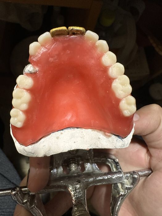 Изготовление сьемных протезов