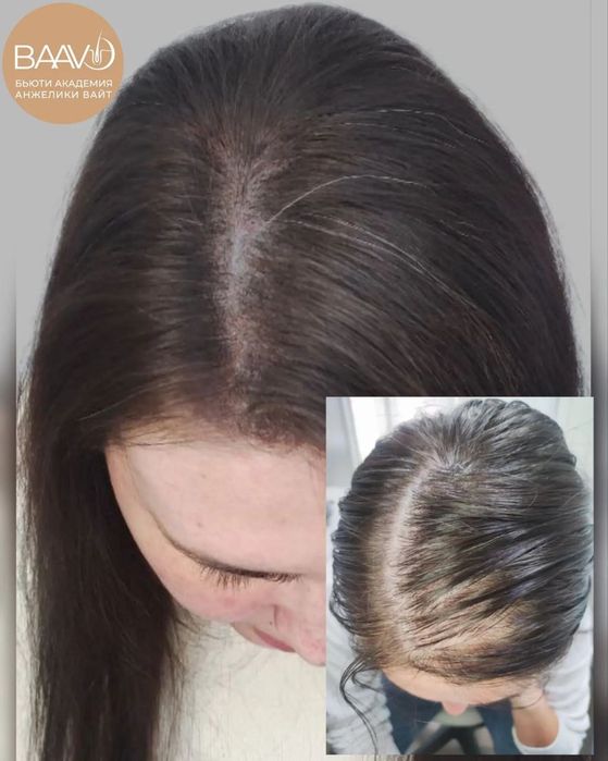 Трихопигментация волос