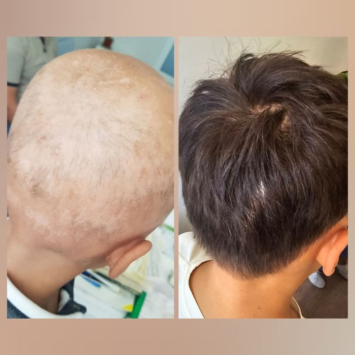 Пищевая добавка для укрепления волос