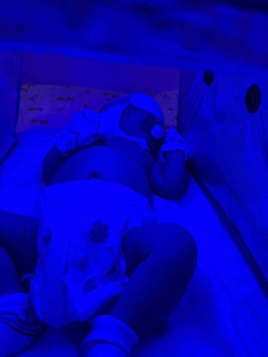 Фотолампа,Продаю Фотолампа от желтухи у детей Есть доставка по городу.