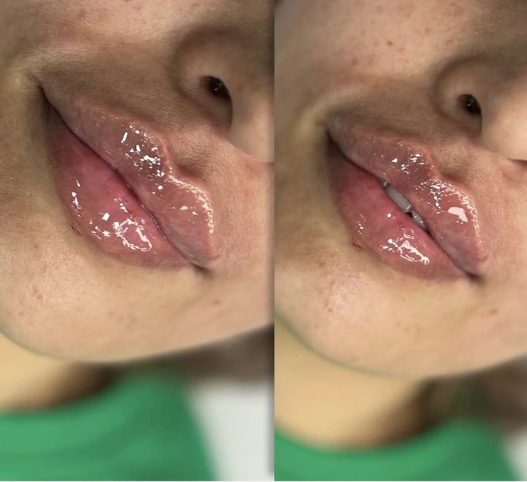 Kosmetologik muolajalar va qosh rastishovkasi