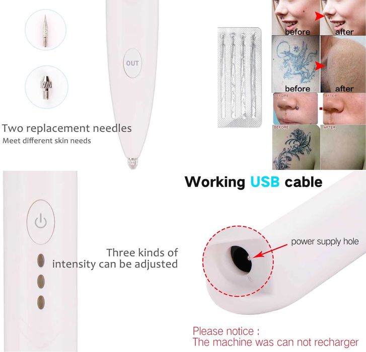 Ручка для удаления бородавок, папиллом, татуировок