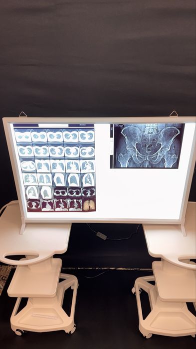 Негатоскоп двух кадровый  размер 77 см на 50 см