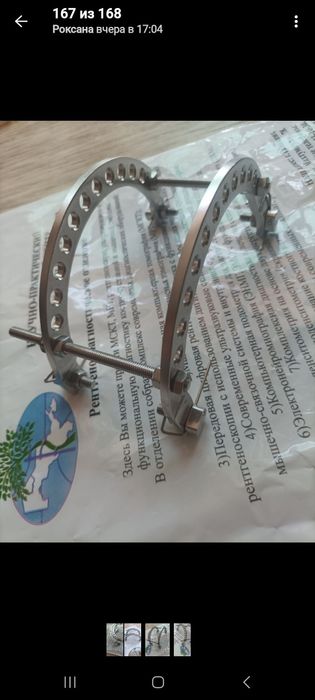 Аппарат Илизарова