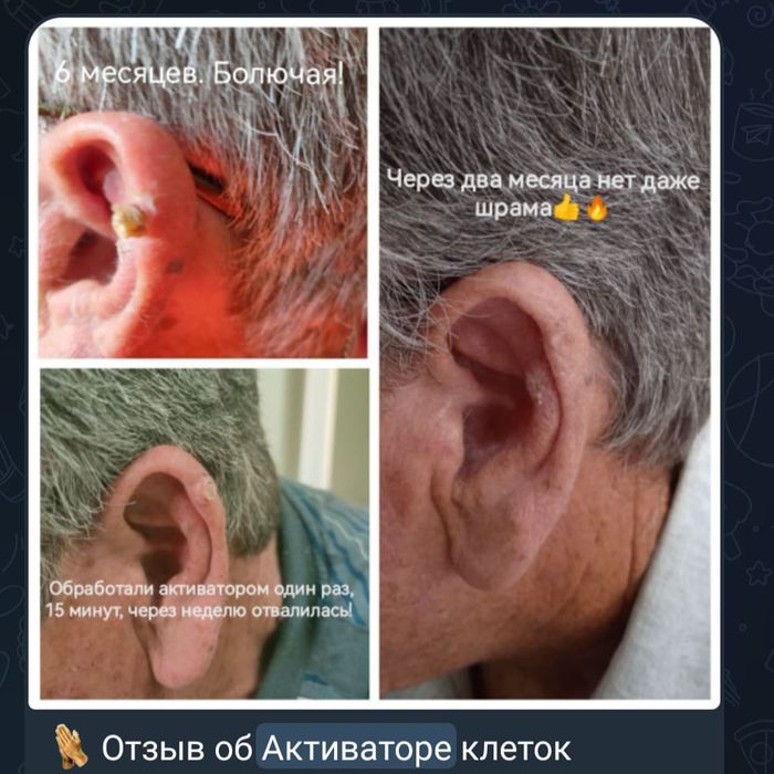 Продаётся Активатор Клеток