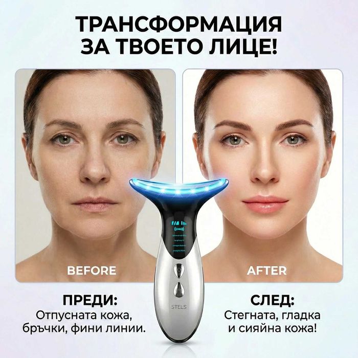 Уред за лифтинг на лице STELS Q32, RF, EMS, LED, безиглена мезотерапия