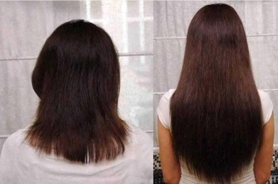 ТОП серията ЗА БЪРЗ РАСТЕЖ на косата ПРОМО ЦЕНА ДО 31.10.