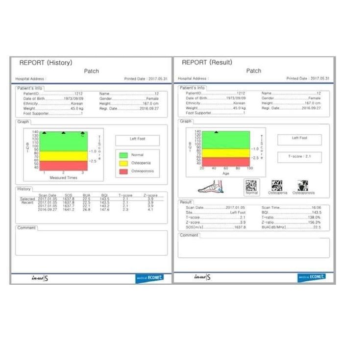 Osteodensimetru Econet Germany Inus S