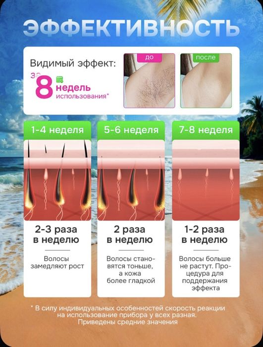 Лазерный эпилятор