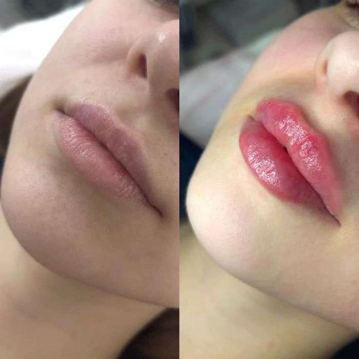 Cosmetolga chistka piling Erkeylar va ayollar uchun