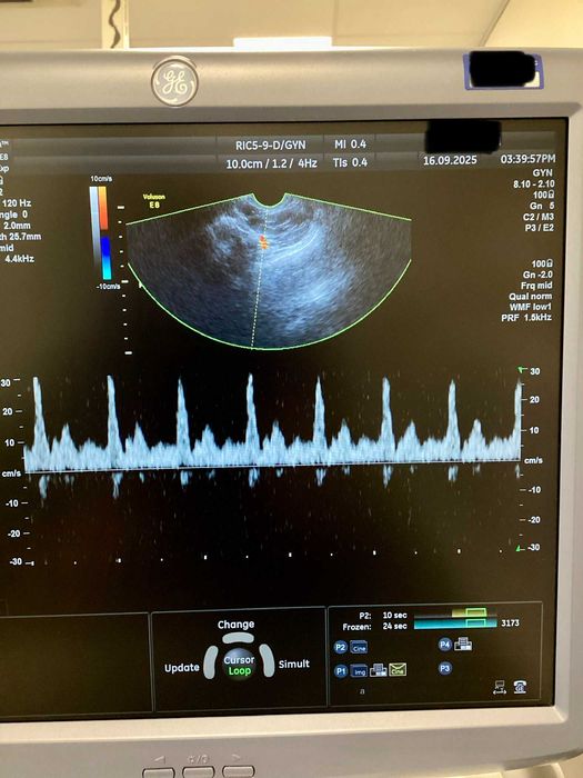 RIC5-9D - Sonda transvaginala 3D/4D Voluson E8 / E10 General Electric