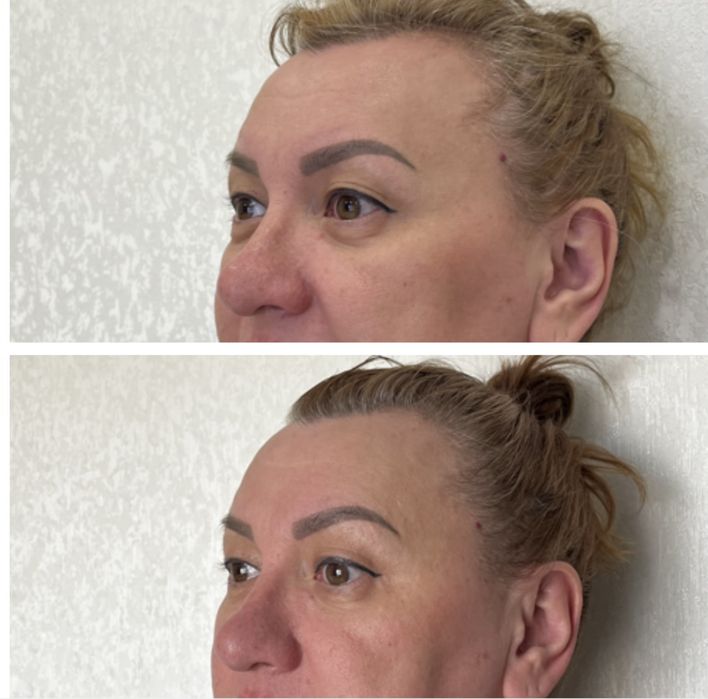 Массаж лица в Караганде