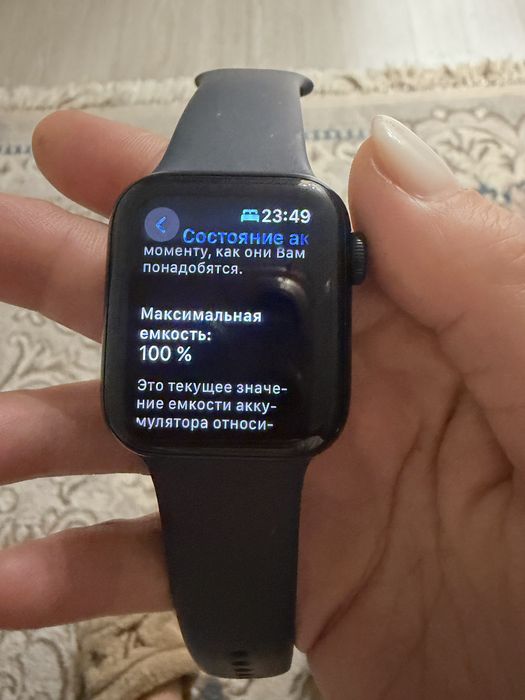 Apple watch series