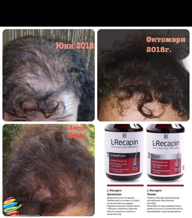 Шампоан и тоник за здрава и силна коса,против косопад