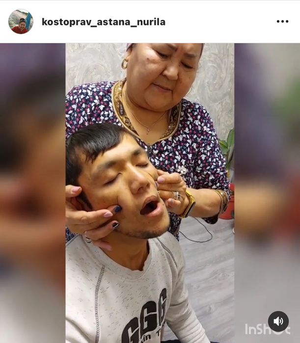 Сыныкшы Сынықшы Костоправ