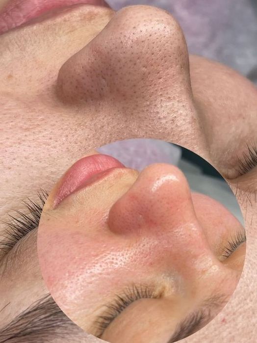 Чистка лица, пилинг, массаж лица, ламинирование ресниц