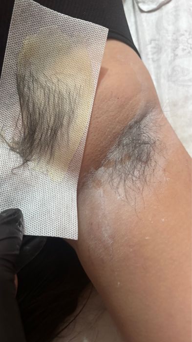 Шугаринг с выездом