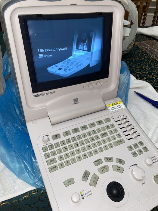 Портативное Узи Mindray