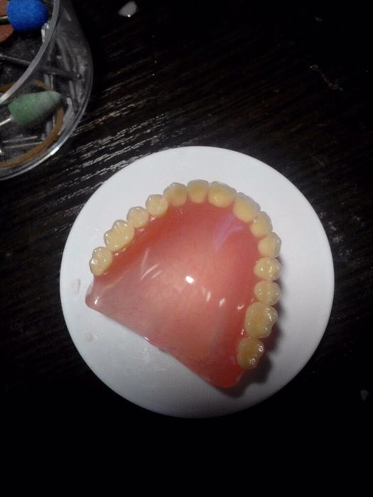 Сьемные протезы!