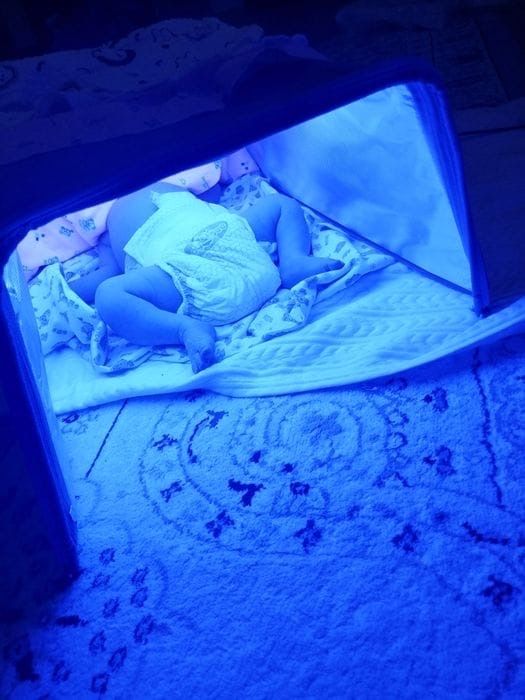 Лампа от желтушки