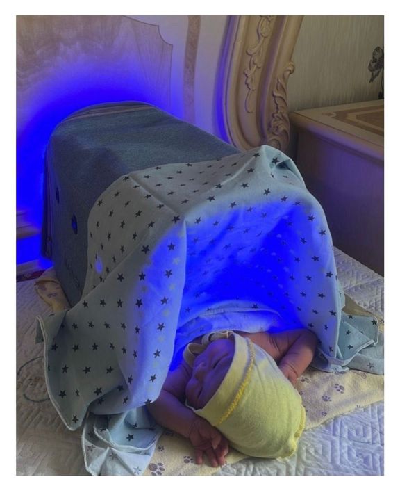 Лампа от желтушки