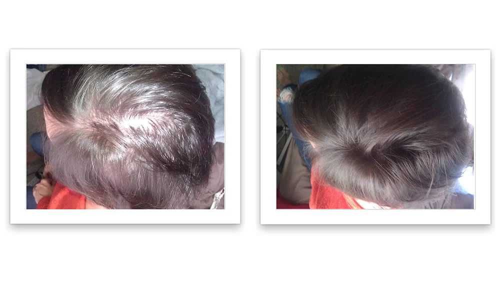 Fibre de par pentru par rar sau chelie - Hairify