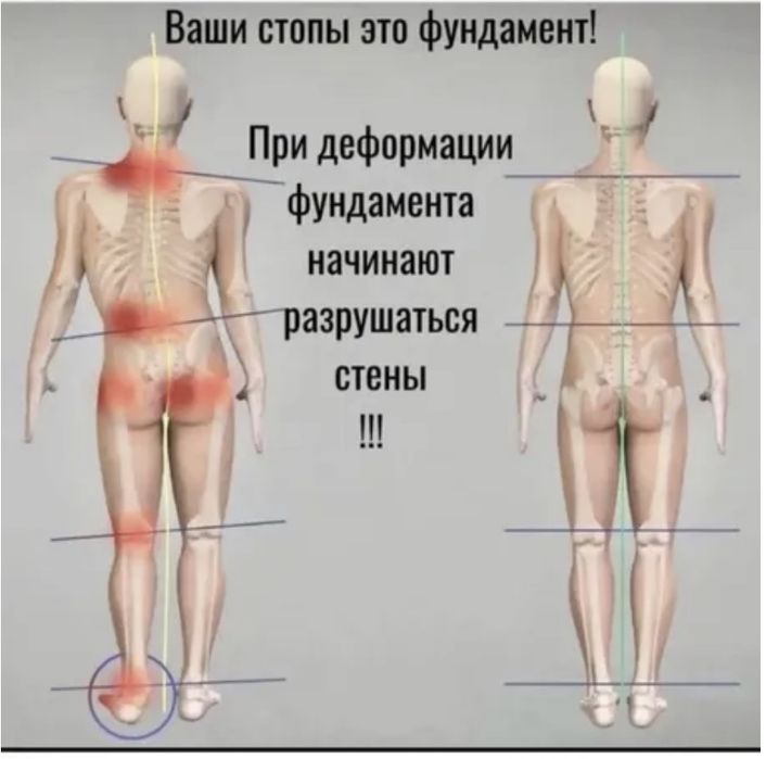 Продам коррекционные стельки