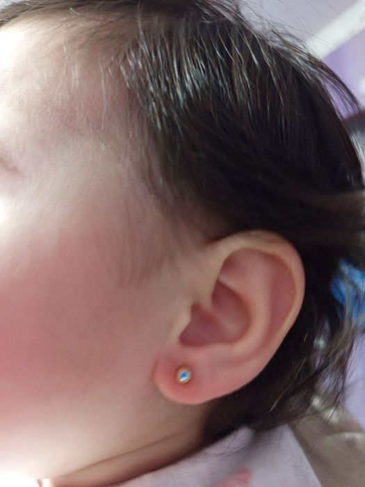 Quloq teshish arzon Og'riqsiz Tez 15-yillik tarjiba